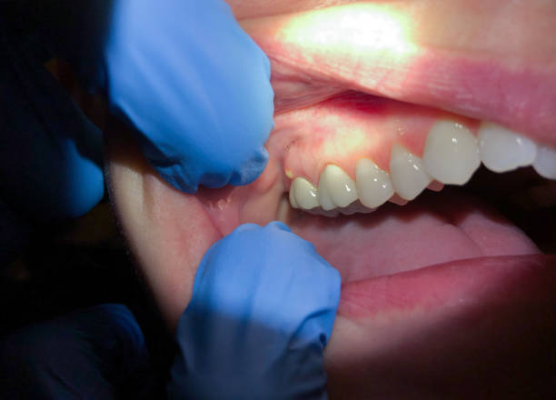 Best Orthodontic Emergency Dentist in Georgetown, PA